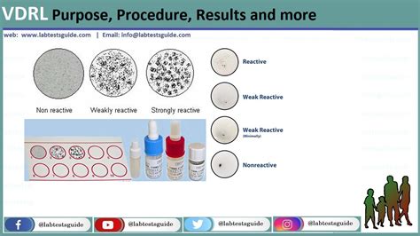 Syphilis Purpose, Causes, Procedure and more - Lab Tests Guide