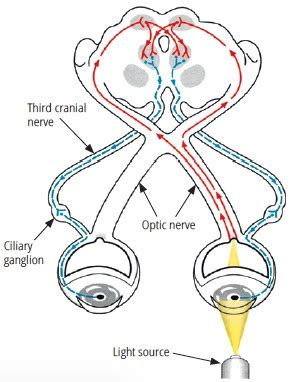 Image 35 of Consensual Light Reflex Pathway | metallichear-t