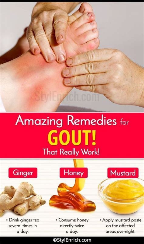 Natural Cures for Arthritis Hands – Home Remedies for Gout Arthritis Remedies Ha…