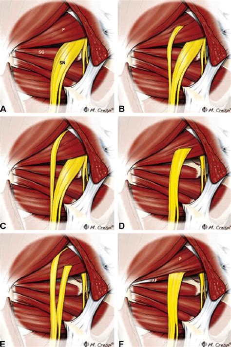 Piriformis Muscle Piriformis Muscle Sciatic Nerve Piriformis | Images ...