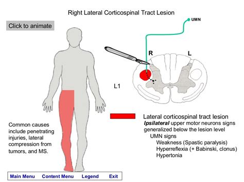 Spinal cord lesions module