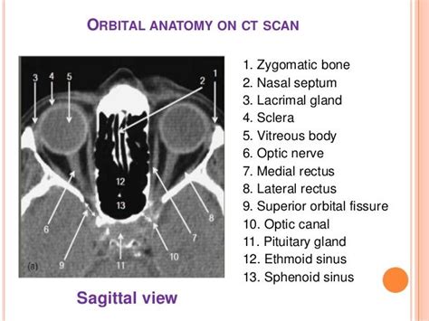 Image result for ct scan eyes | Ct scan, Orbit anatomy, Anatomy