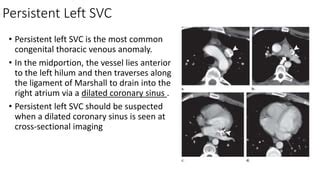 ANATOMY EMBRYOLOGY AND IMAGING OF SVC.pptx