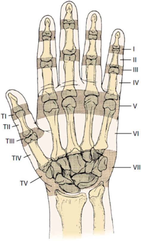 Extensor Tendon Repair - Hand Clinics