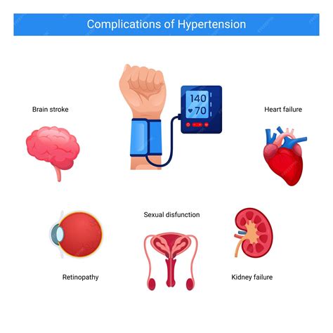 Infografía de complicaciones de hipertensión. | Vector Premium