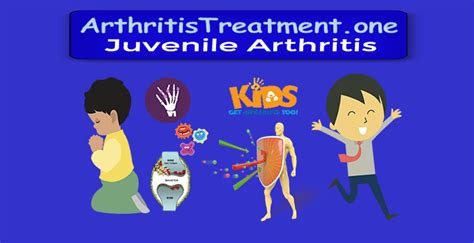 #1 Natural Treatment for Juvenile Arthritis - Natural Relief