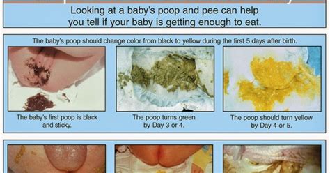 Breastfed Poop Chart