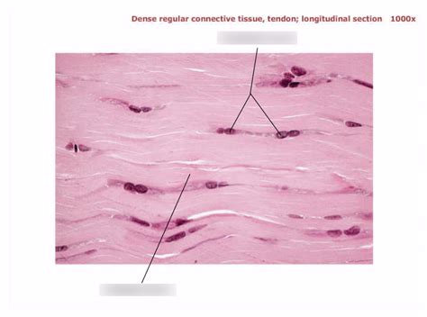 Dense regular connective tissue, tendon; longitudinal section 1000x Diagram | Quizlet