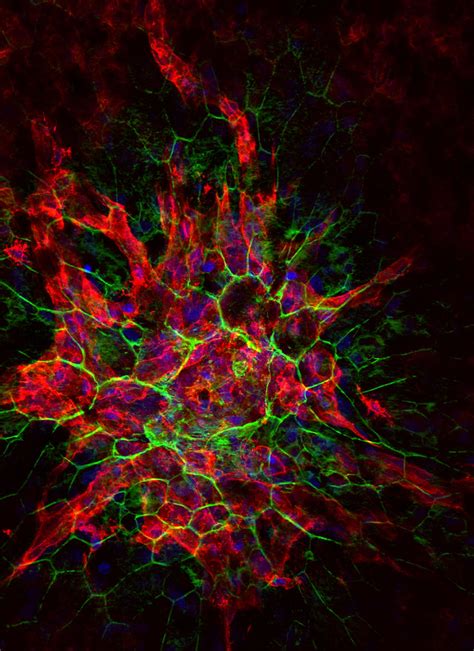 Confocal microscope image of laser-induced choroidal neova… | Flickr