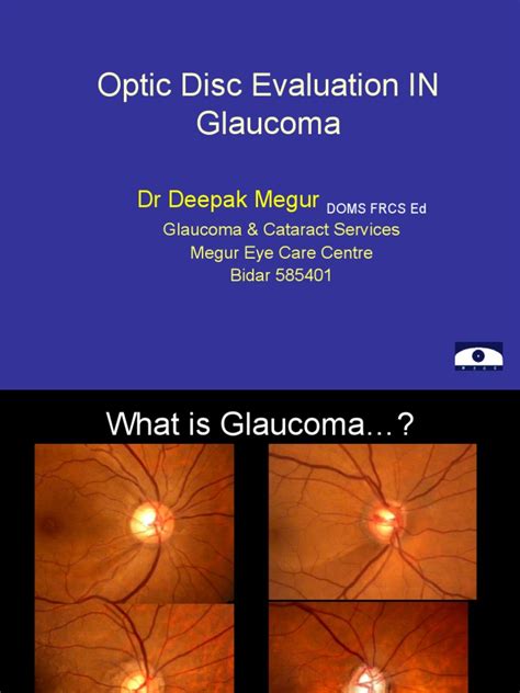 22-Optic-Disc-Evaluation-IN-Glaucoma.ppt | Retina | Glaucoma