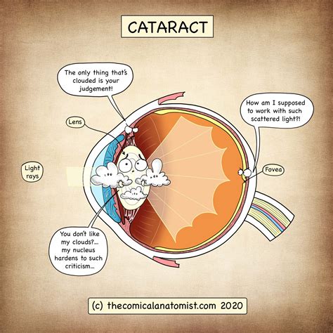 Eye Pathology Archives - The Comical Anatomist