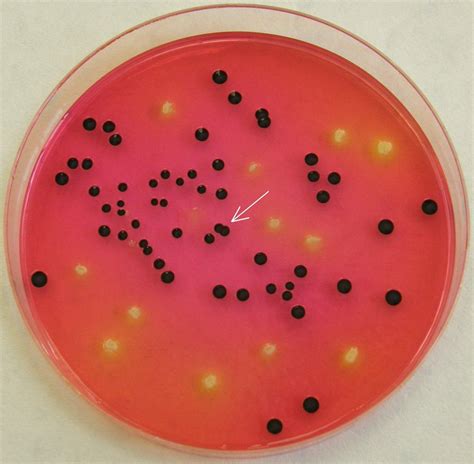 Salmonella On Xld Agar / Pp0320 Xld Agar E O Laboratories Ltd ...