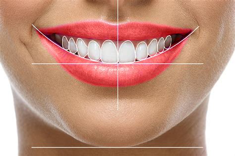 Smile design by dr Mostarac | Digital smile design | Dental centar Mostarac