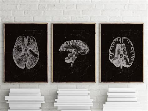 Black and White Anatomy, Radiology Art Print, Human Brain Art, Medical Art, Nervous System ...