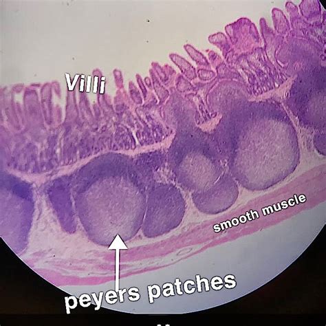 Ileum Histology.