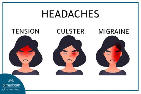 Cluster Headache Causes and Treatment in Turkey - Bimaristan