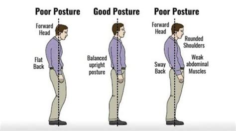 Posture-Related Ailments – Meyer & Snyman Physiotherapy