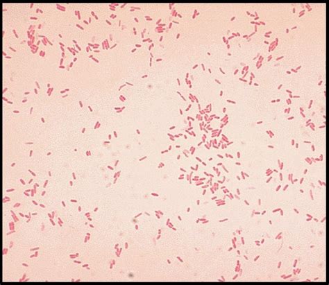 Aeromonas hydrophila