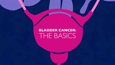 Bladder Cancer Archives | Department of Urology