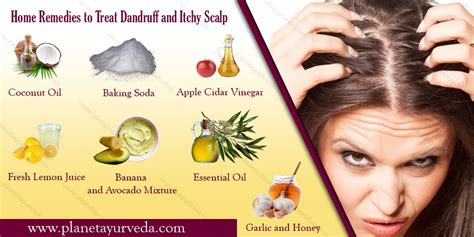 Natural Dandruff Remedies | ubicaciondepersonas.cdmx.gob.mx