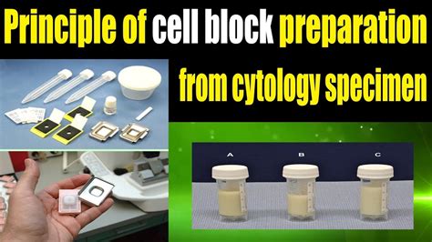 principle of cell block preparation from cytology specimen - YouTube