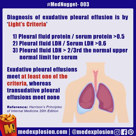 https://img.grepmed.com/uploads/8814/exudate-pleuraleffusion-mednugget-im-respiratory-original ...