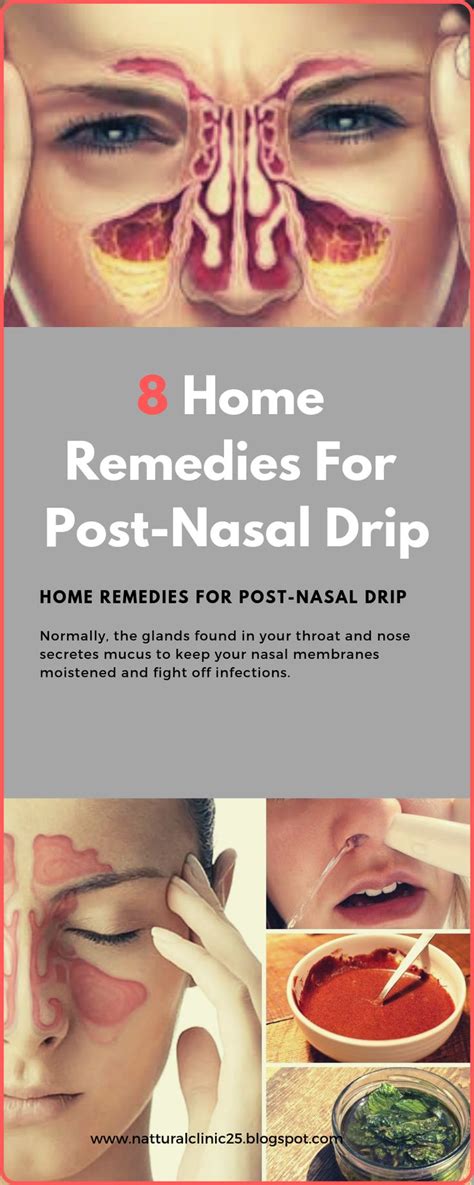 8 Home Remedies For Post-Nasal Drip | Remedies, Herbal medicine, Herbalism