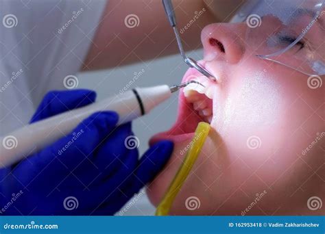 Stomatologist Dentist Makes Ultrasonic Cleaning Teeth To Woman, Closeup View. Stock Photo ...