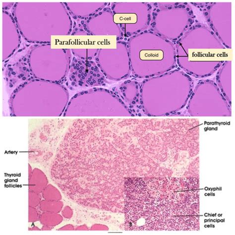 Thyroid Histology C Cells