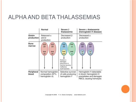 PPT - Hemolytic anemias - Hemoglobinopathies PowerPoint Presentation, free download - ID:729365