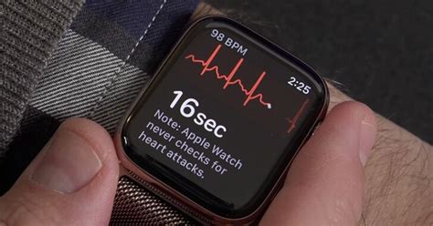 apple watch ecg 心電圖 – Cathybreen