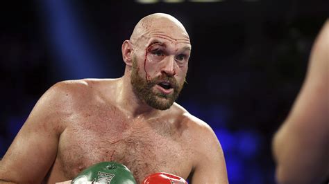 Tyson Fury overcomes bloody cut over eye to beat Otto Wallin – Orlando ...