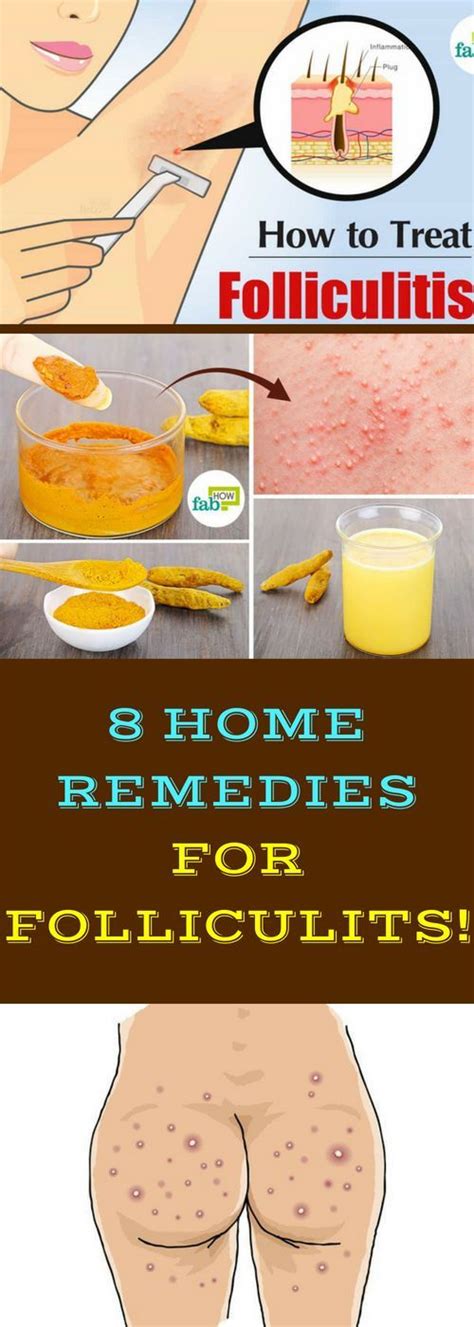 8 HOME REMEDIES FOR FOLLICULITIS! | Skin treatments, Skin care pimples ...