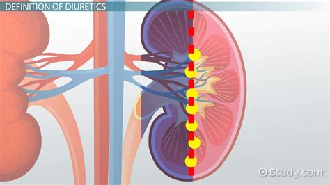 What Are Diuretics? - Definition, Types, Side Effects & Examples ...