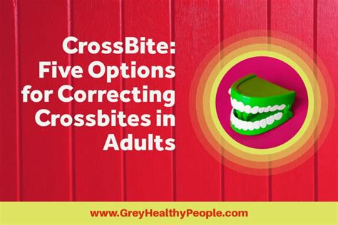 Crossbite: 5 Options for Correctiing Crossbites in Adults