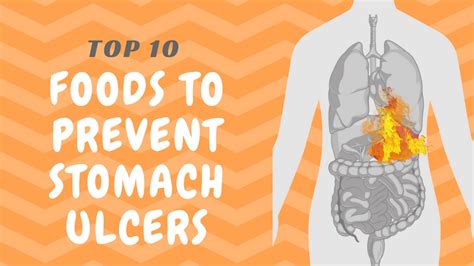 Ulcer In Stomach Diet