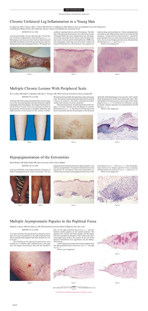 Multiple Chronic Lesions With Peripheral Scale | Dermatology | JAMA Dermatology | JAMA Network