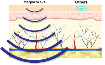 The Benefits of MagnaWave | Making Waves PEMF Therapy