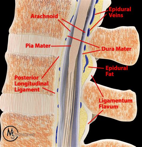 Spinal Epidural Lipomatosis with Review of Visceral Fat Deposition in Obesity - Radsource