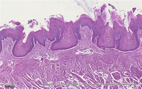 Tongue Muscle Histology