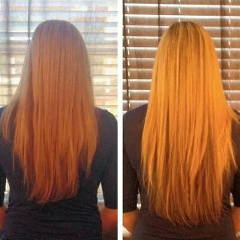 Hair Skin Nails results before and after! Get that Mermaid hair! Get it at a 40-45% savings when ...