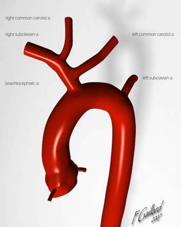 ON - RADIOLOGY: Aortic arch in MRA and its Variations