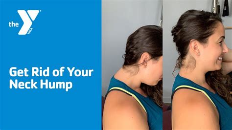 Easy Fix For The Neck Hump! (With FREE Exercise Sheet!) | atelier-yuwa.ciao.jp