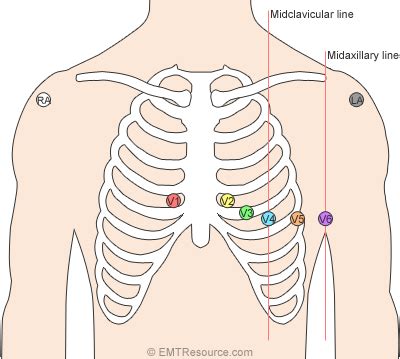 Pin on Nursing Student Helps!