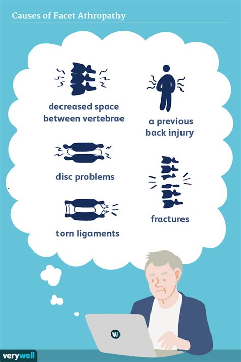 Facet Arthropathy Symptoms and Treatments