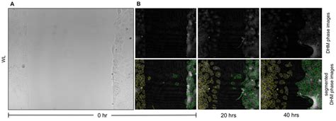 Visualization of epithelial wound healing by white light microscopy and... | Download Scientific ...