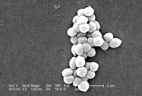 Free picture: scanning, electron micrograph, gram, positive, micrococcus luteus, bacteria