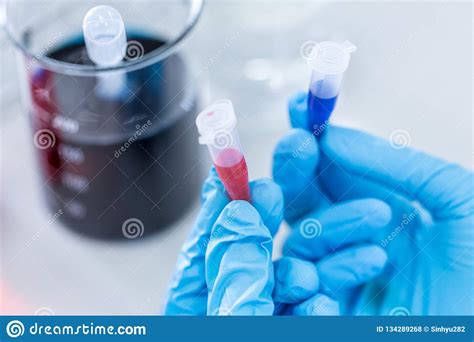 Biochemical Analysis and Chemical Analysis in Lab. Stock Photo - Image ...