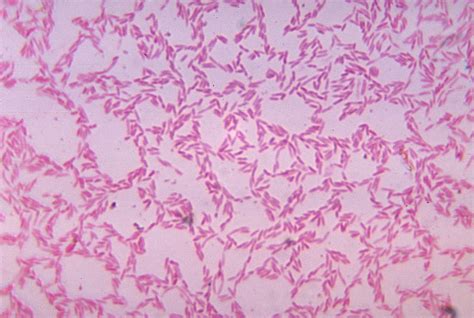 Gram Negative Bacilli (Rods) - Microbiology learning: The "why"ology of microbial testing