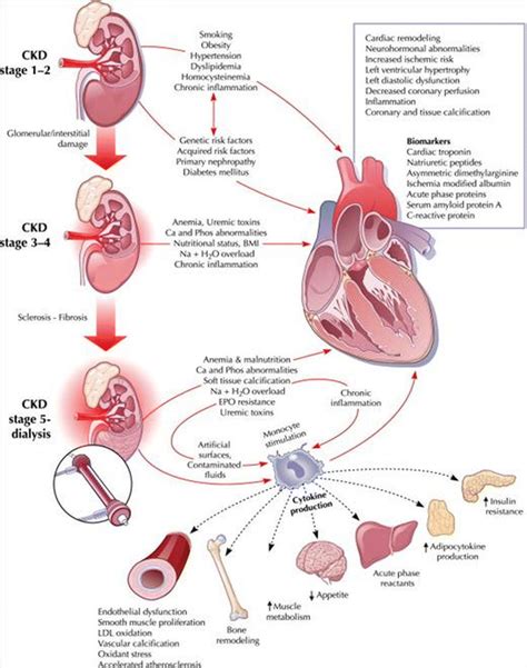 Chronic kidney disease and cardiovascular complications | SpringerLink